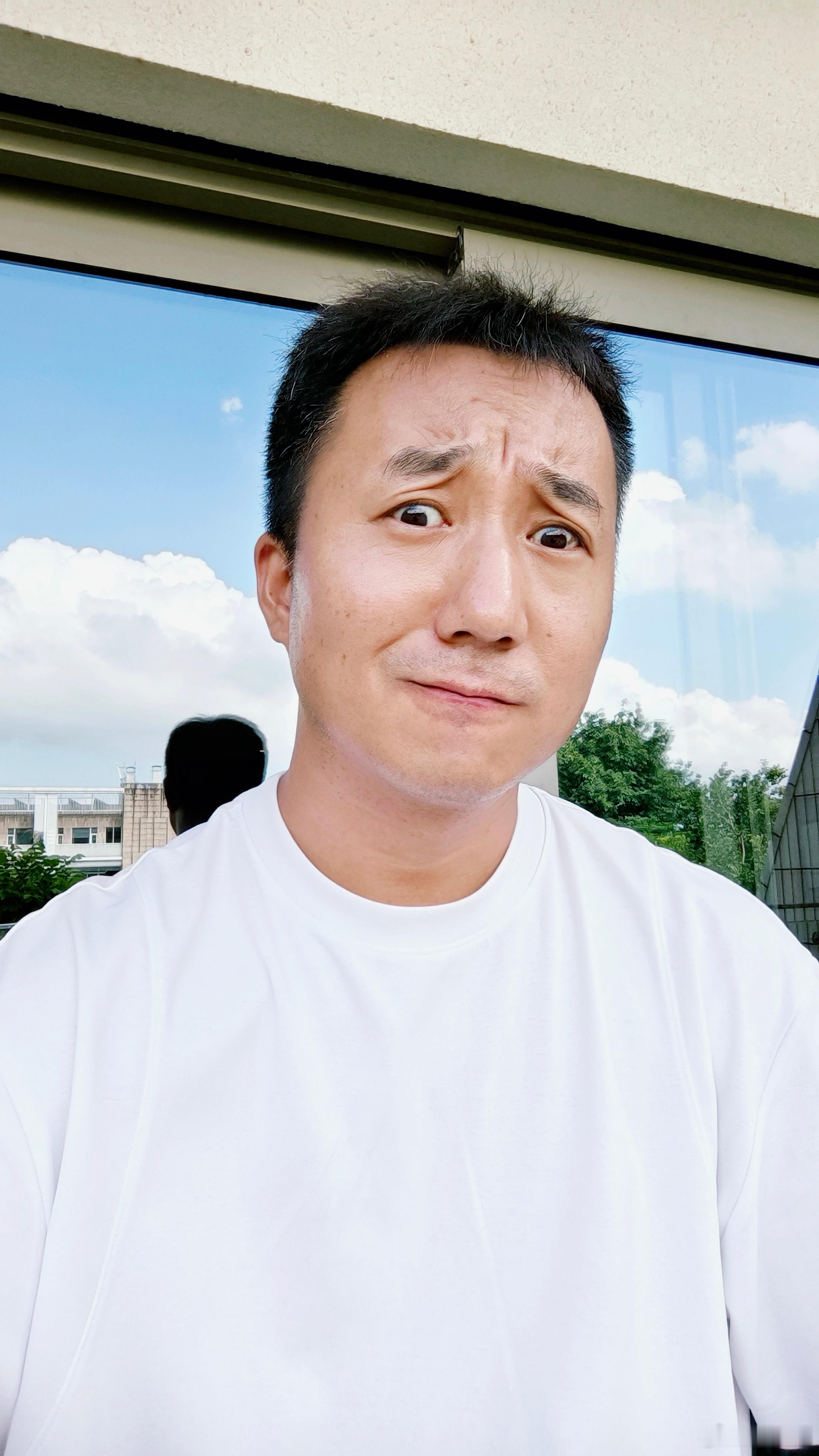深圳的蚊子这么凶的吗？昨天在户外待了不到2小时，我的腿快被蚊子叮成无量仙翁的头了