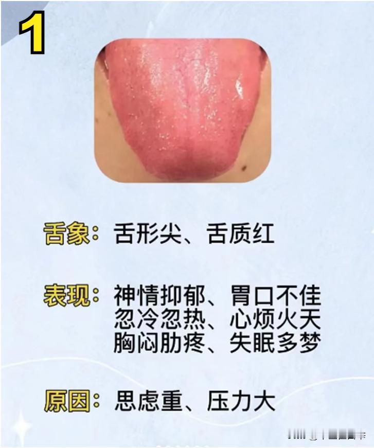 每天坚持给大家看舌象
湿热、寒湿、脾虚、肾虚、肝火、阳虚，你的身体到底存在哪些问