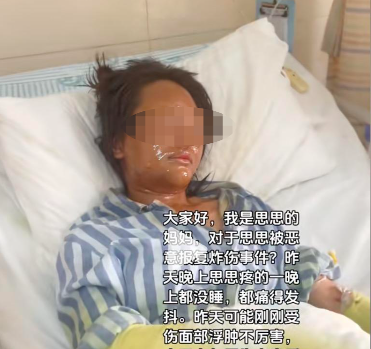 对话被伪装快递盒炸伤女主播:嫌疑人放易燃物时疑戴面具,被其骚
