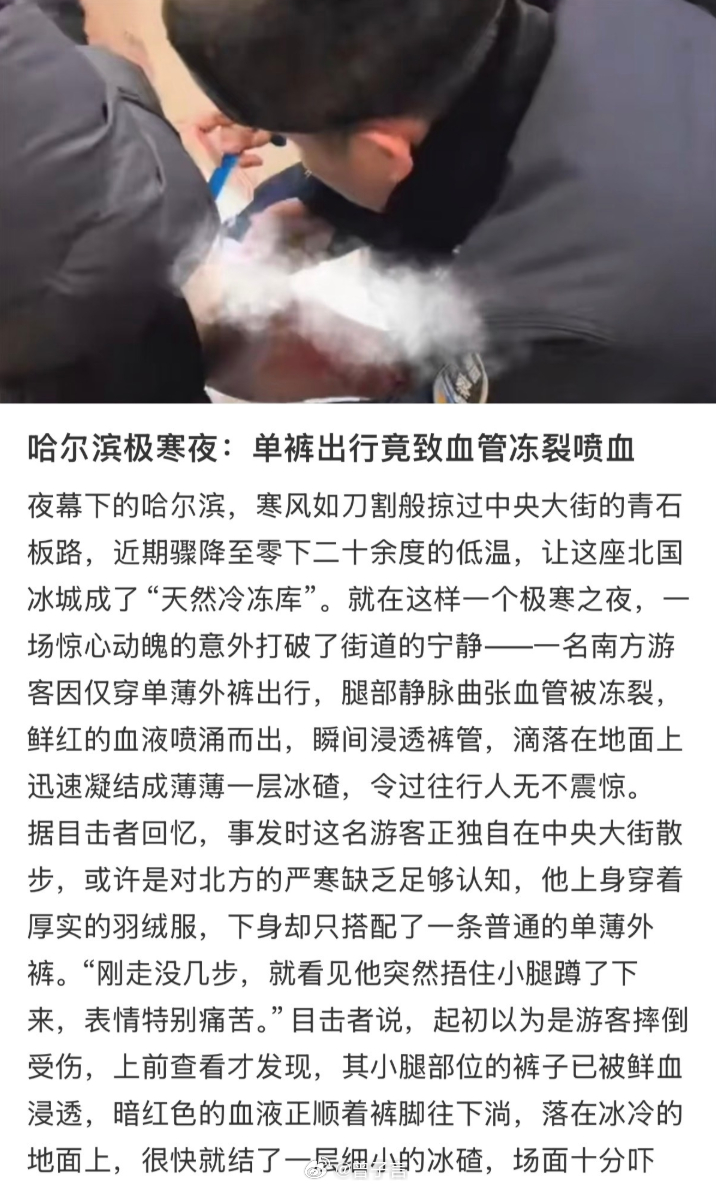 零下二十多度穿一条单裤就出门了 … 这是一点生活常识都没有啊！南方小土豆们喜欢冬