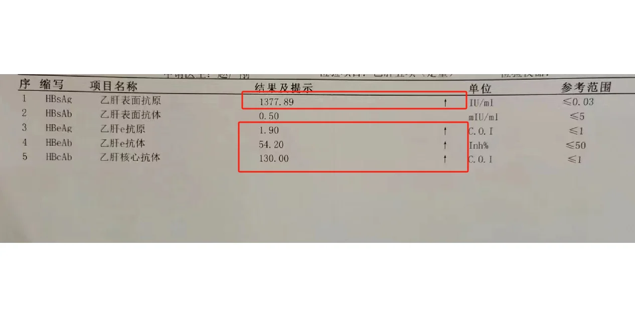 乙肝五项1345阳什么意思呢？你知道吗？