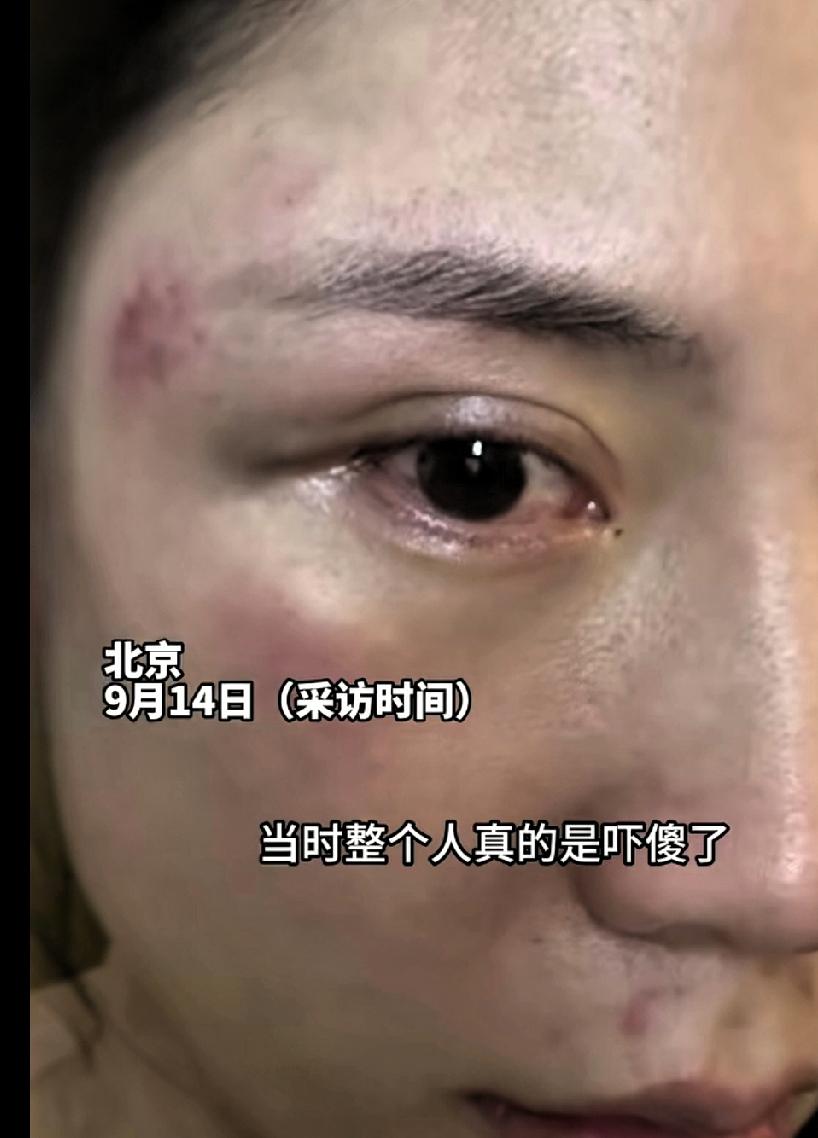 冰雹夜袭北京，姑娘被砸哭！两大哥肉身挡冰雹，全网泪崩

2025年9月13号傍晚