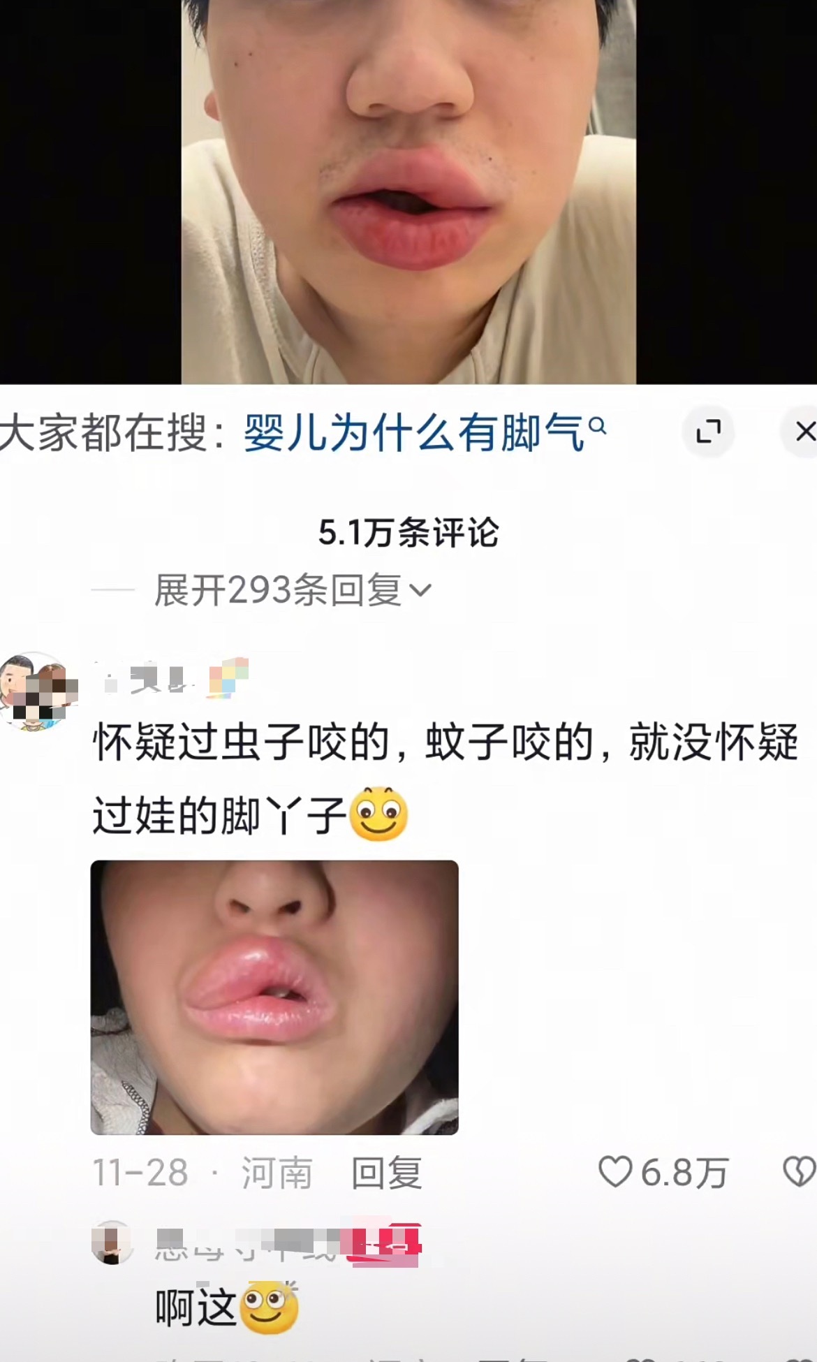 女子亲宝宝脚丫嘴唇肿成香肠长知识了，小宝宝脚丫也暗藏细菌，接触不当嘴唇、眼睛都容