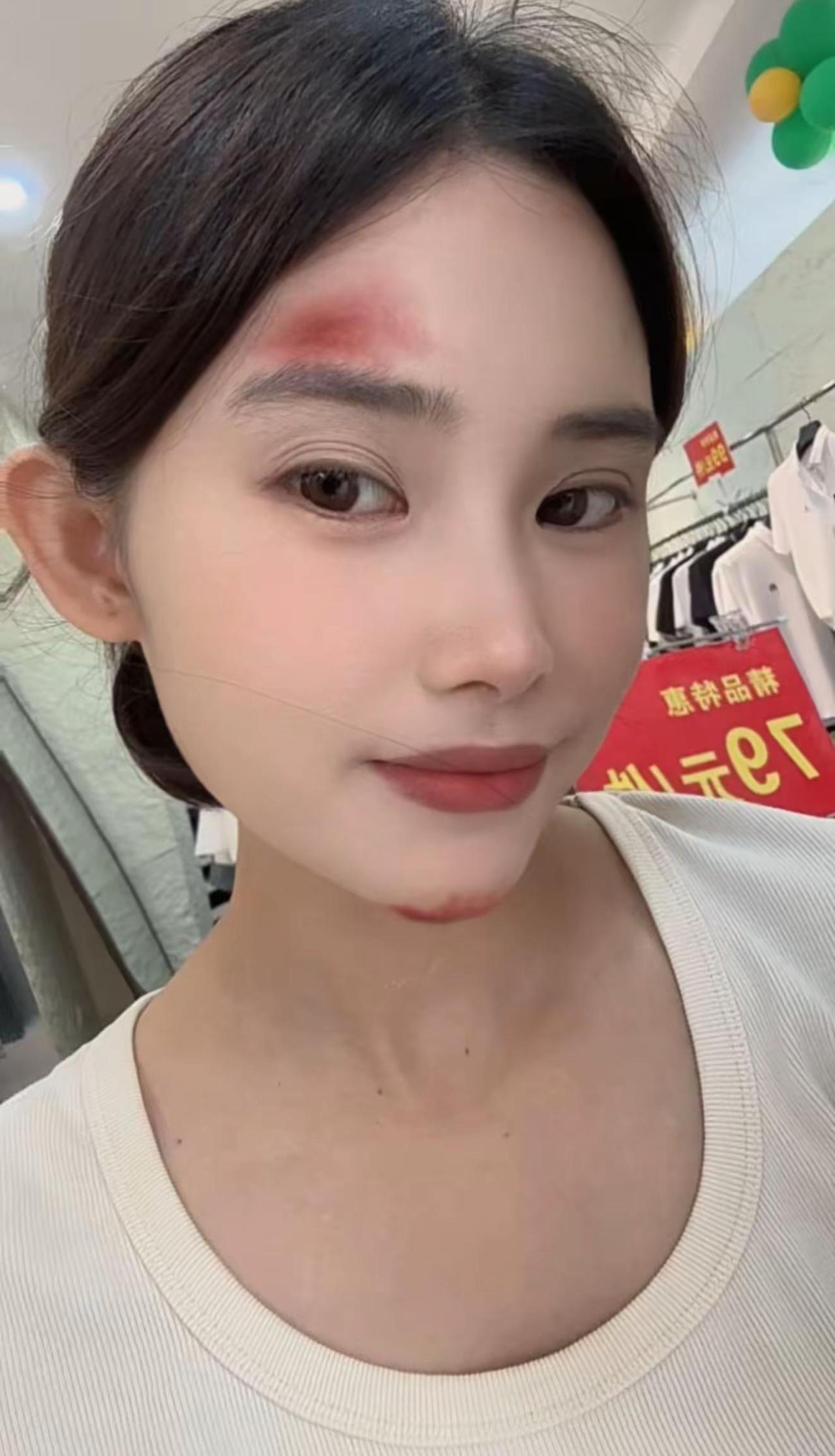 没事的