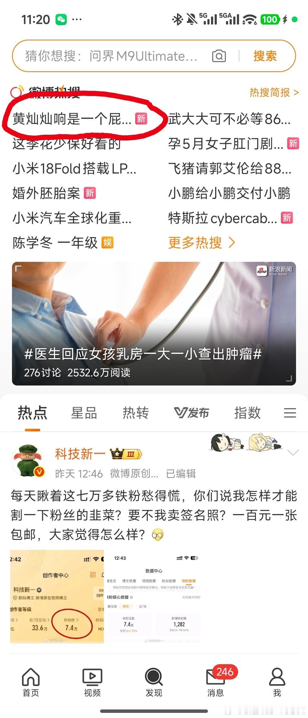黄灿灿响是一个屁股对着你的小狗回头看你看成了“黄灿灿一个响屁……”哈哈哈哈哈哈哈