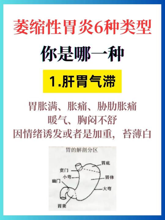 萎缩性胃炎6种类型，你是哪一种？