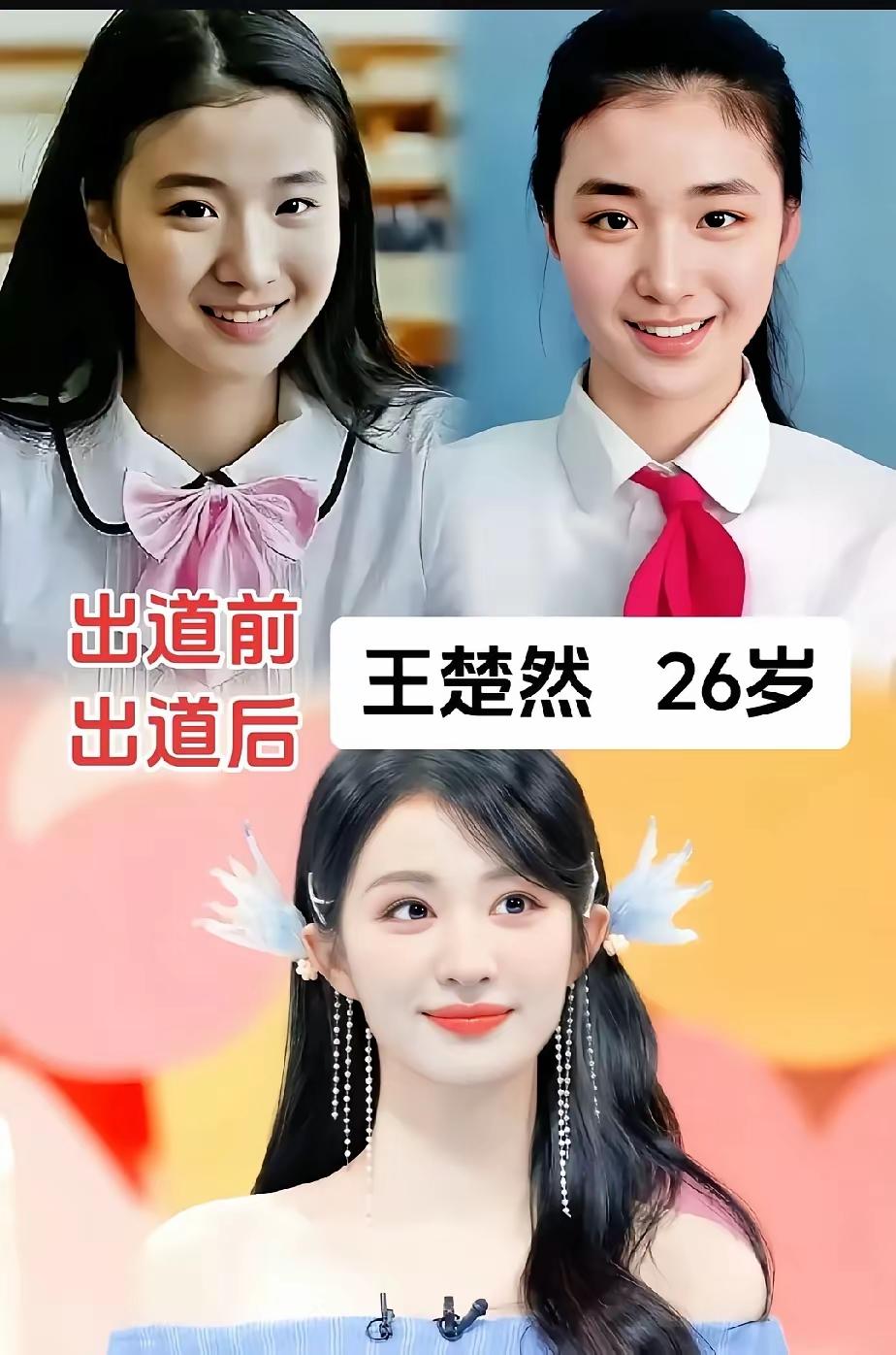 明星出道前后惊人的变化 。好多明星出道前后变化挺大的 ，有人说他们是整了容，有人