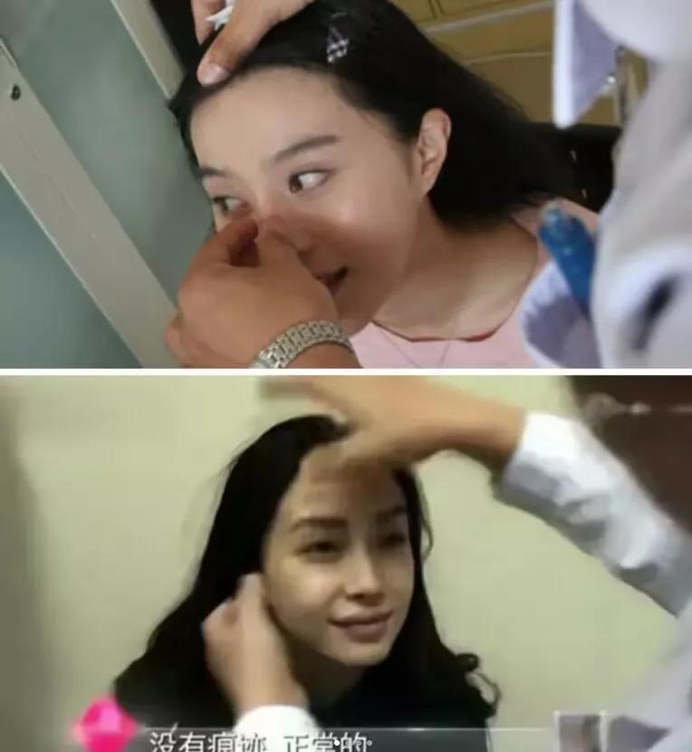 那些年，做过整容鉴定的女明星们
以前女明星为自证没有整容，亲自代记者到医院做鉴定