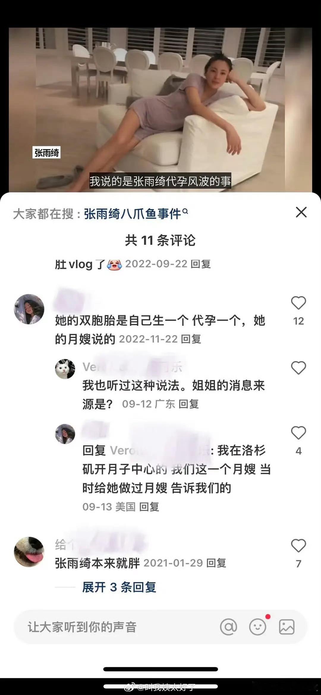 #双胞胎生一个代一个# 这🍉传到 张雨绮 那里了[吃惊] ​​​