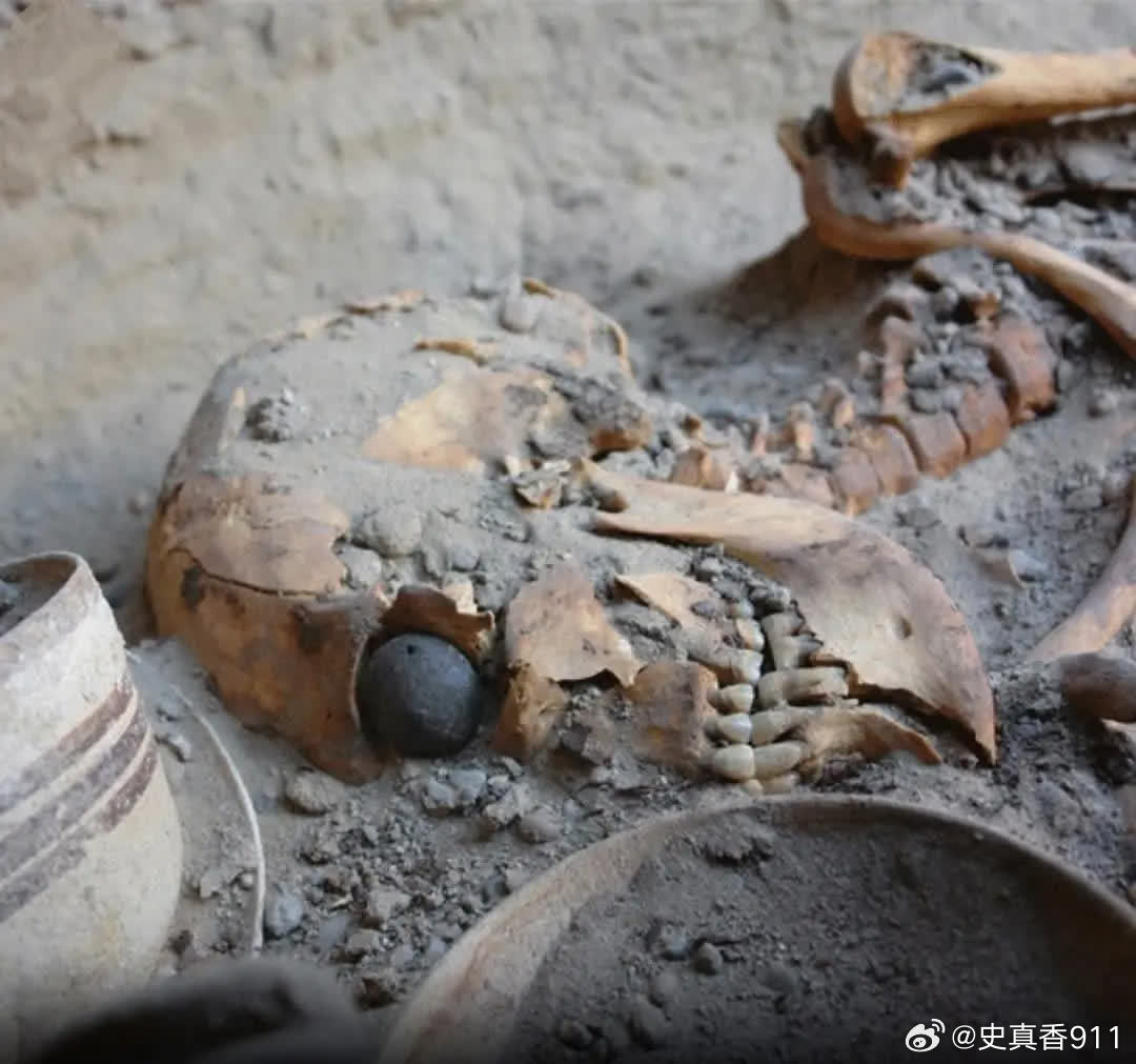 2006年，伊朗考古学家发现了一具距今近5000年的女性头骨，其眼窝内安放着一只