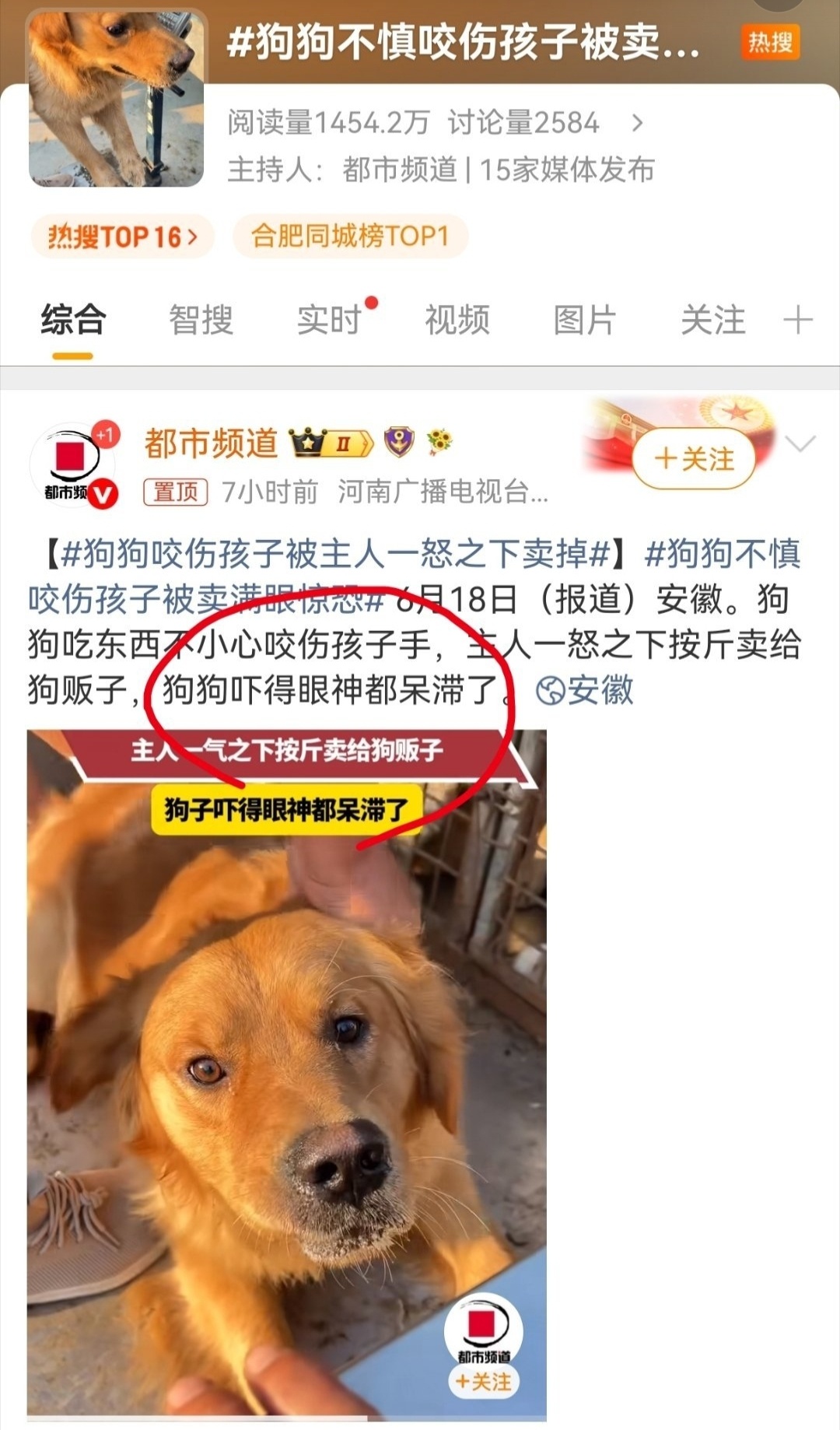 狗狗不慎咬伤孩子被卖满眼惊恐  不关心被咬的孩子，关心狗干啥呀？这个狗一旦咬人了