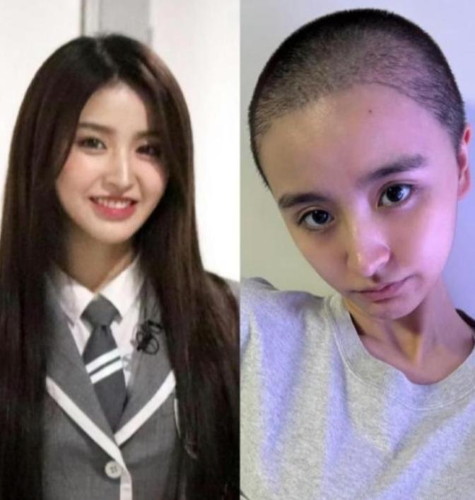 前爱豆金子涵自曝惨遭非人对待，被注射不明液体、三年闭经、耳朵长霉近乎失聪，整个内