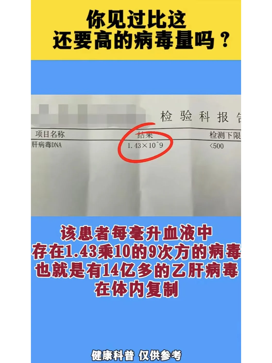 乙肝病毒量怎么看？ 
