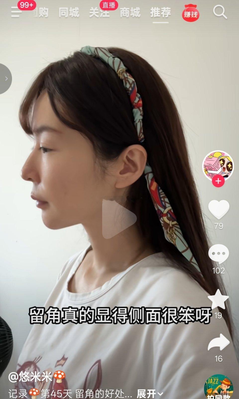 我完全不认可图1、图2、图3里的说法。她说“下颌能不能挂得住肉，不取决于有没有下