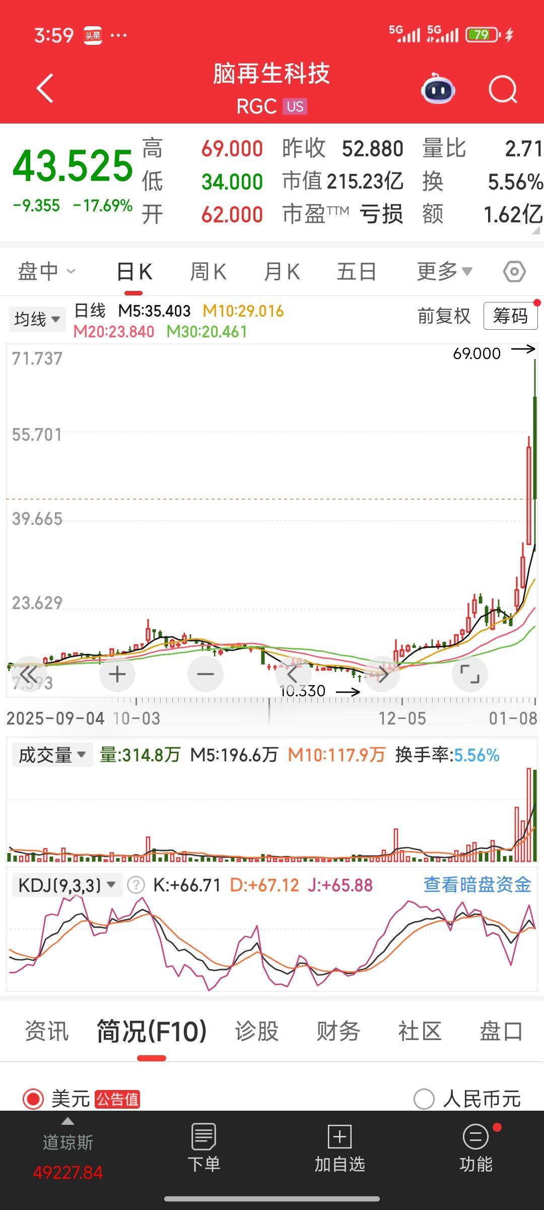 今天A股的脑机接口概念要面临考验了。昨晚美股的脑再生科技大幅放量下跌。由于目前A