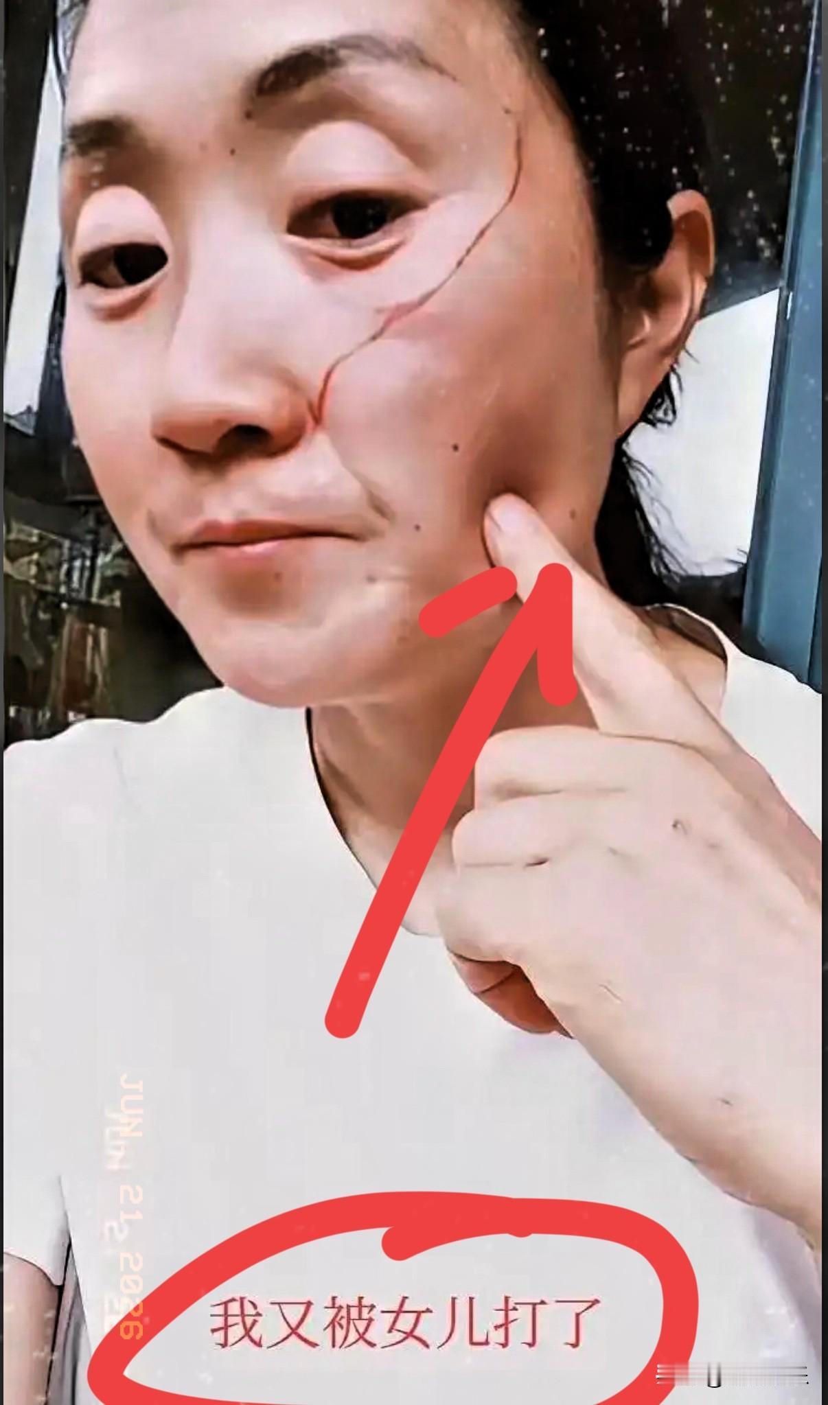 妈妈被高考完的女儿打破脸，原因是她中午做饭吵醒了女儿，女儿先是砸东西，妈妈说了她