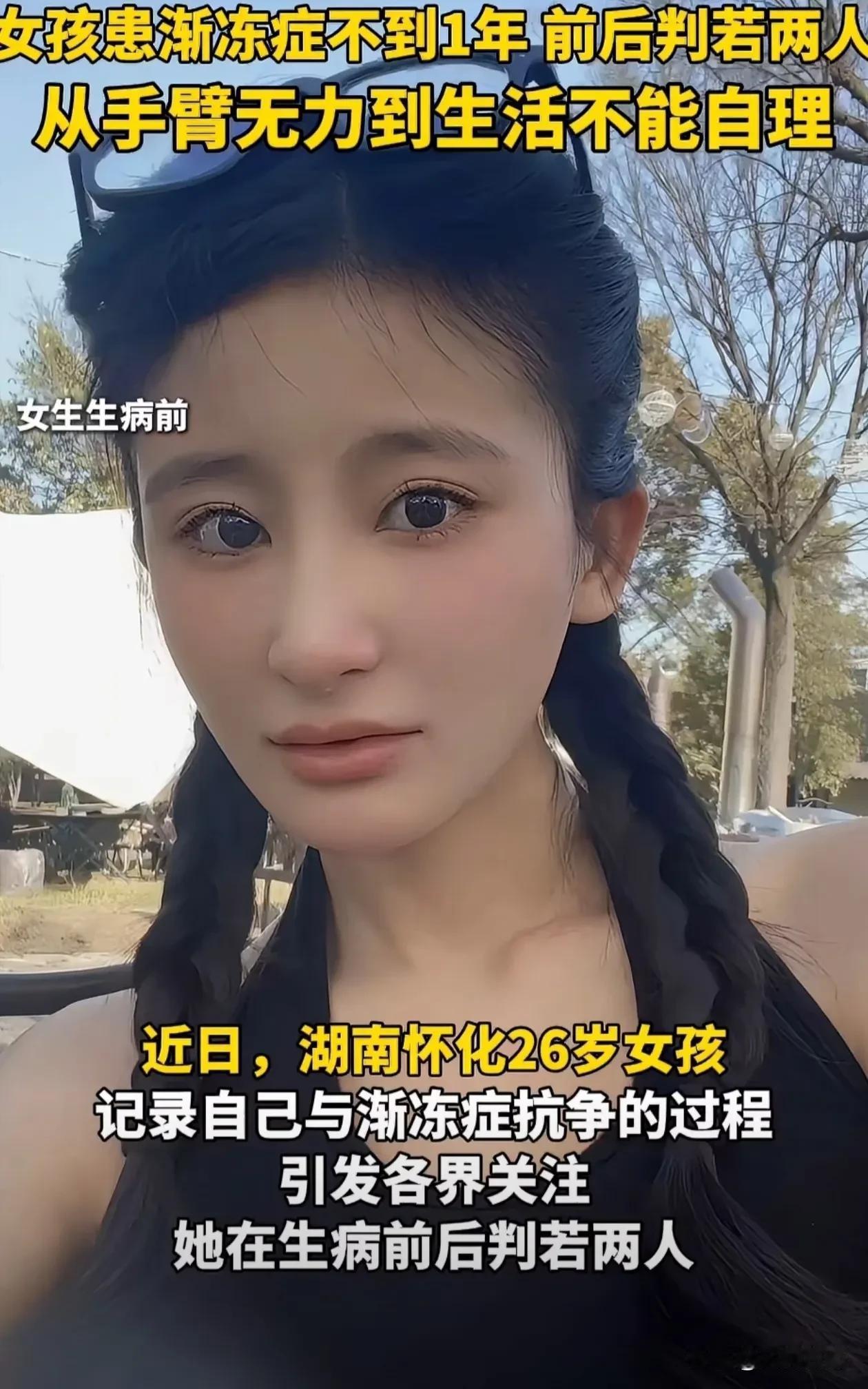 湖南省多么漂亮的姑娘，被渐冻症毁了
湖南省怀化市，一位活泼漂亮的程姑娘一开始只是
