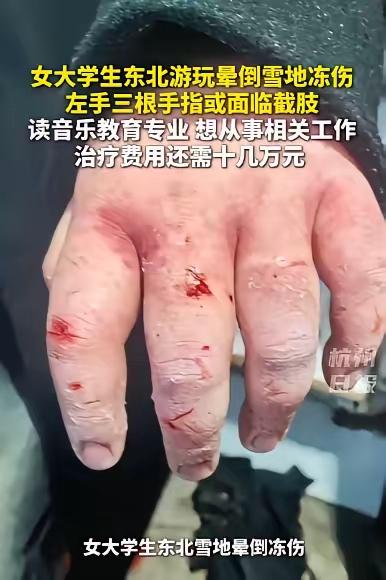 这个姑娘去东北玩，冻伤了看到了吧！要不是被发现了，下一步就是冻死了，别说十几万了