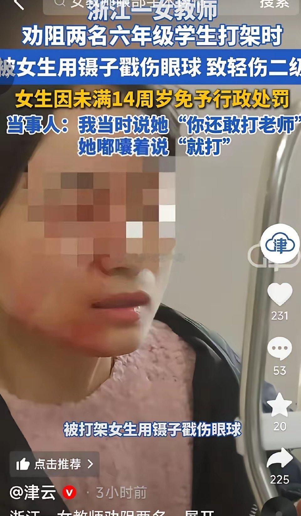太让人心痛了。浙江42岁的女老师因为给学生劝架，竟然让一个女生拿镊子戳伤了右眼，