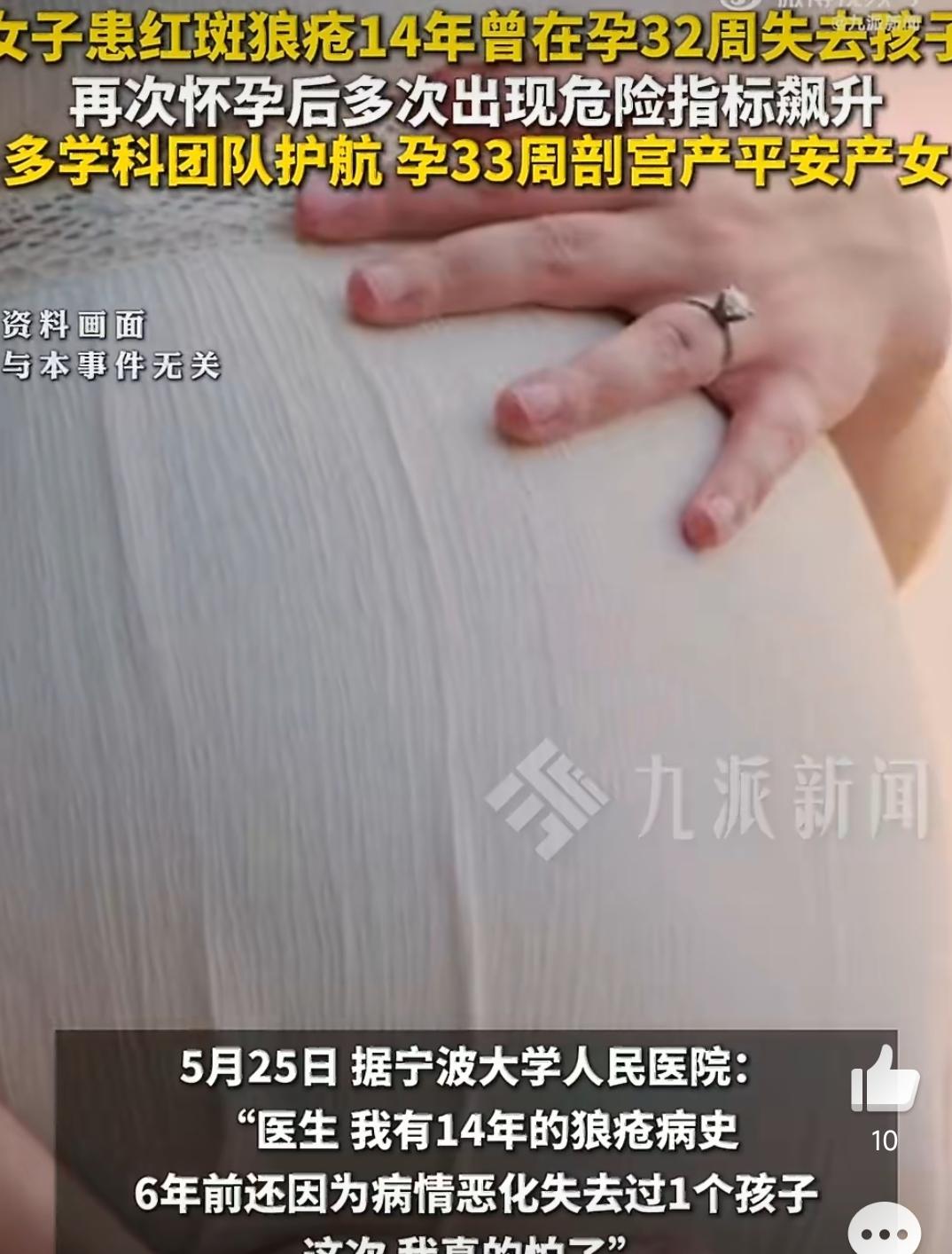 韩女士患系统性红斑狼疮（SLE）14年，12年前合并狼疮性肾炎。6年前首次怀孕至