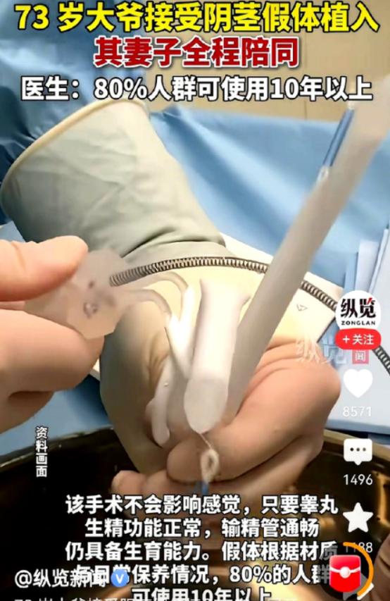 73 岁男子为比自己小 30 多岁的妻子改善夫妻生活，主动接受阴茎假体植入手术，