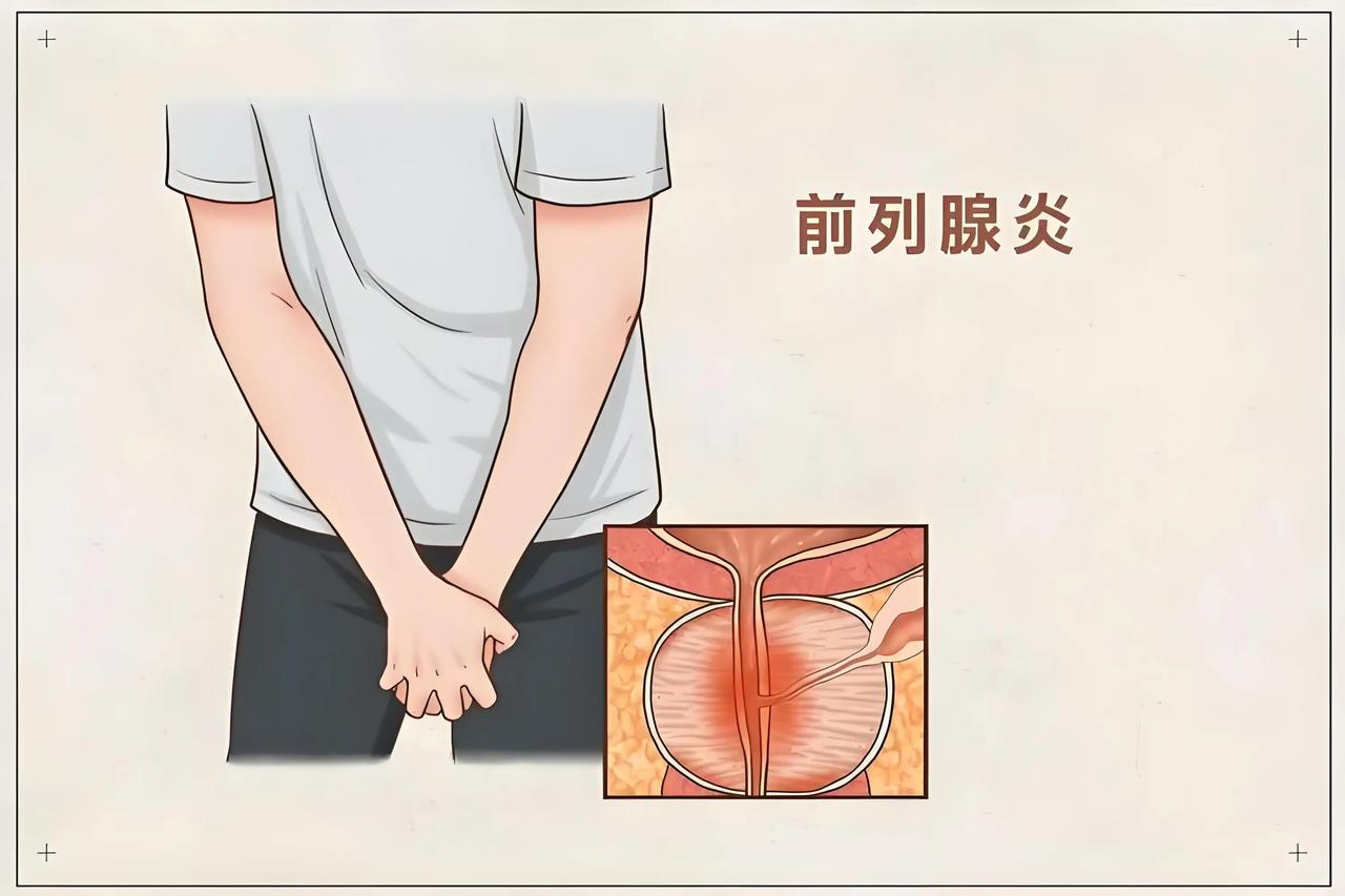 前列腺炎是不是非常容易复发？







最近伴随着天气变冷，很多患有前列腺炎