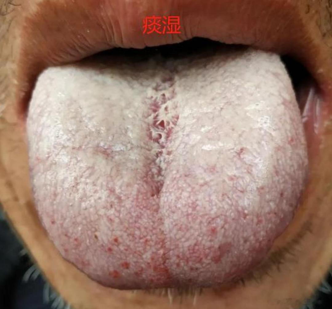 他耗费2个月从上海走到北京，彻底走掉了一身痰湿！[赞]作者：罗大伦#中医式生活#
