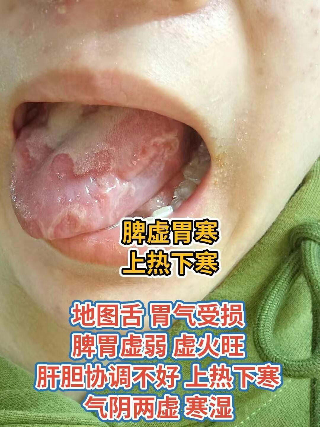 看看你是哪一种？评论区发个舌头，我来分析
