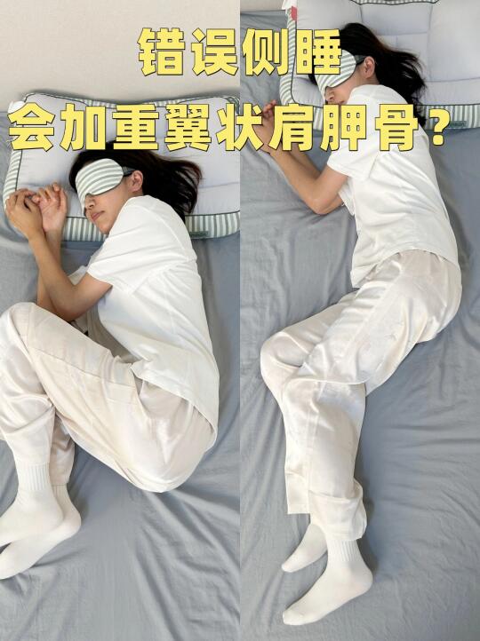 侧睡真的会加重翼状肩胛吗？