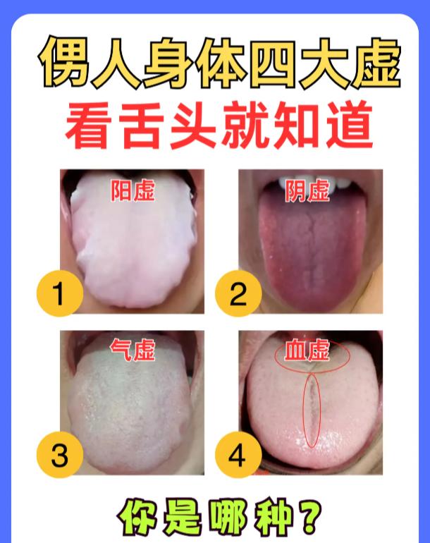 男士常见四种体虚，看舌苔便能分辨