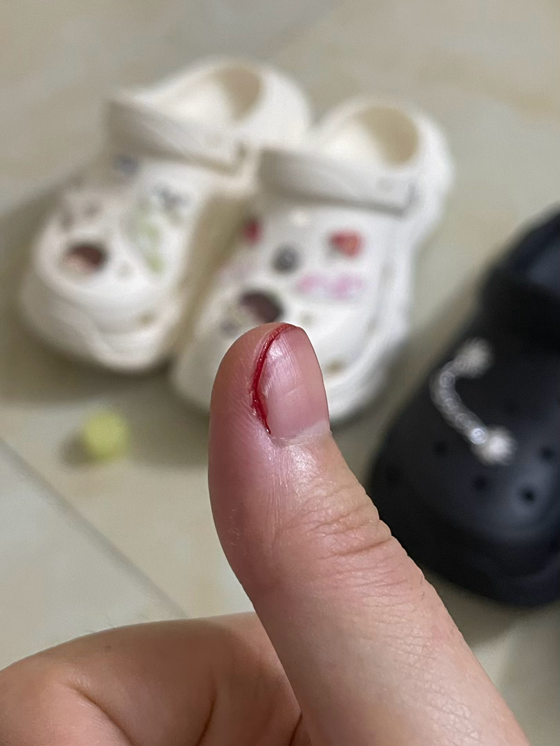 我是一个被洞洞鞋害出血了也要给它点赞的人。 