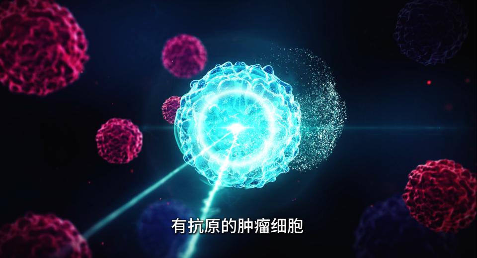 CAR-T疗法助力七旬患者绝境突围