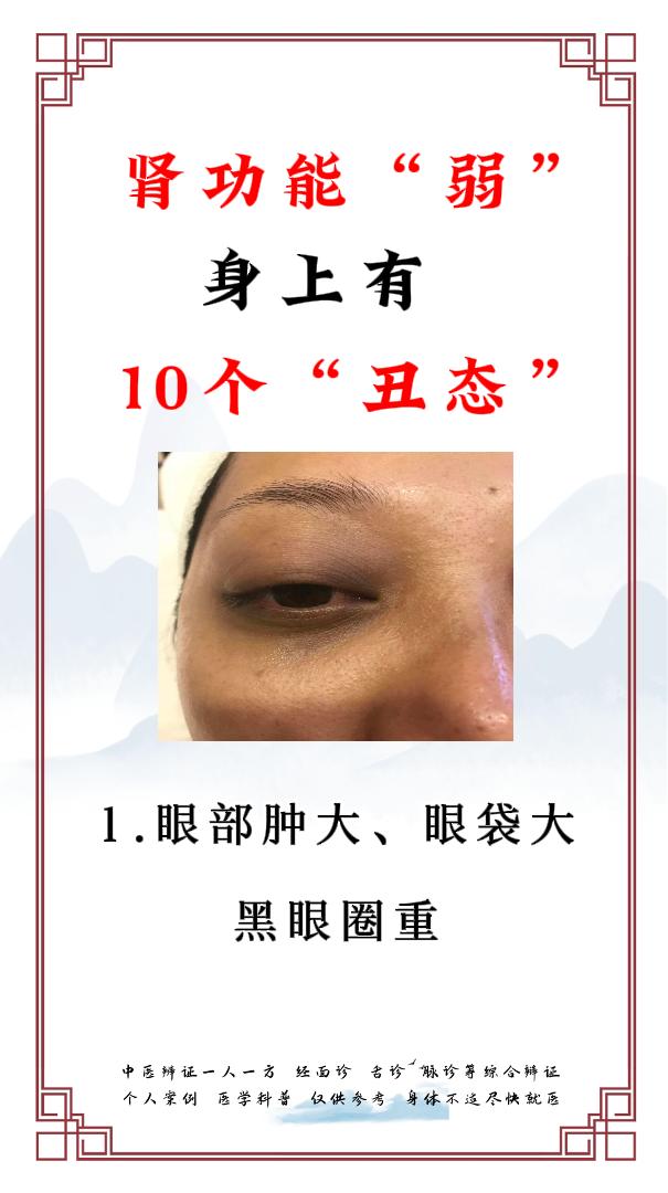 肾功能弱，身上有10个“丑态”