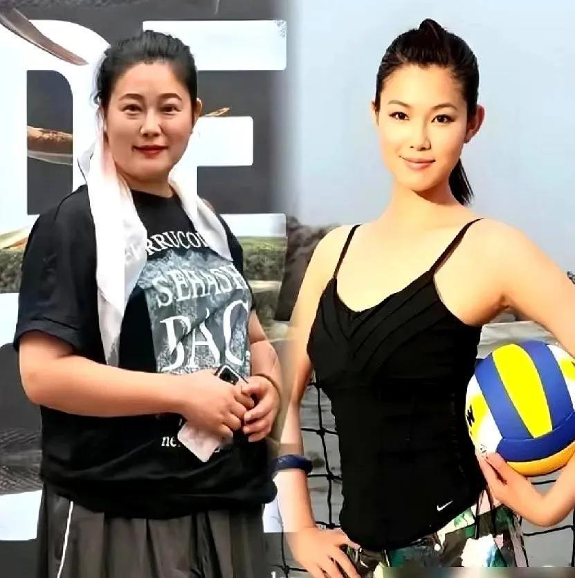 于娜减肥后，慢慢的恢复体形，五官也更清晰立体。