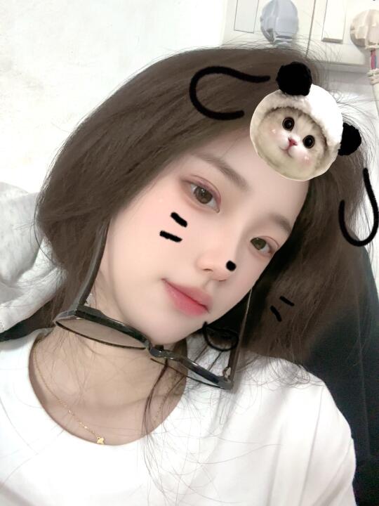 小陈的埋线之旅