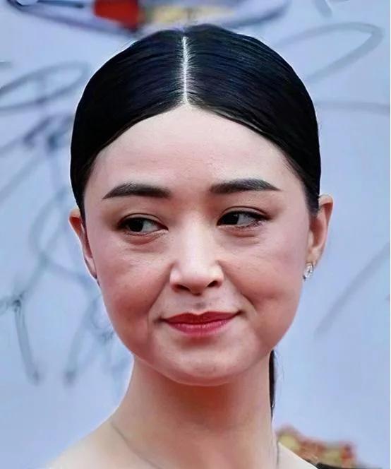 蒋欣高清照：面庞发腮，眼袋深刻，法令纹一目了然，额纹若隐若现；脸上的小痘痘小斑点