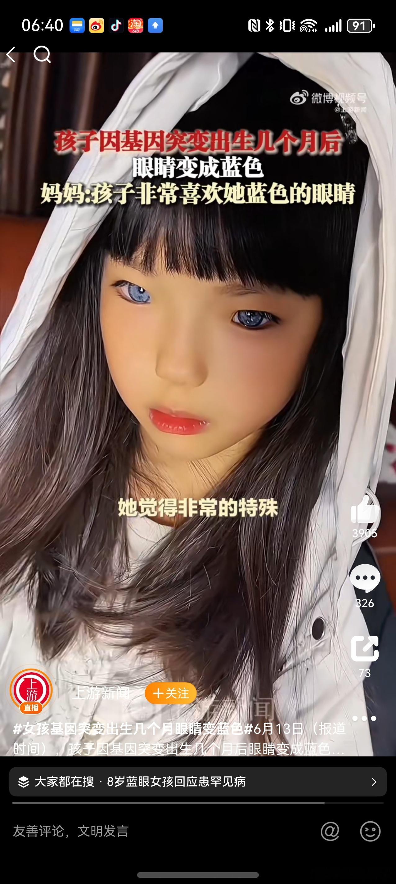 女孩基因突变出生几个月眼睛变蓝色 这在班级里不得横着走啊，妥妥就是故事里的公主 