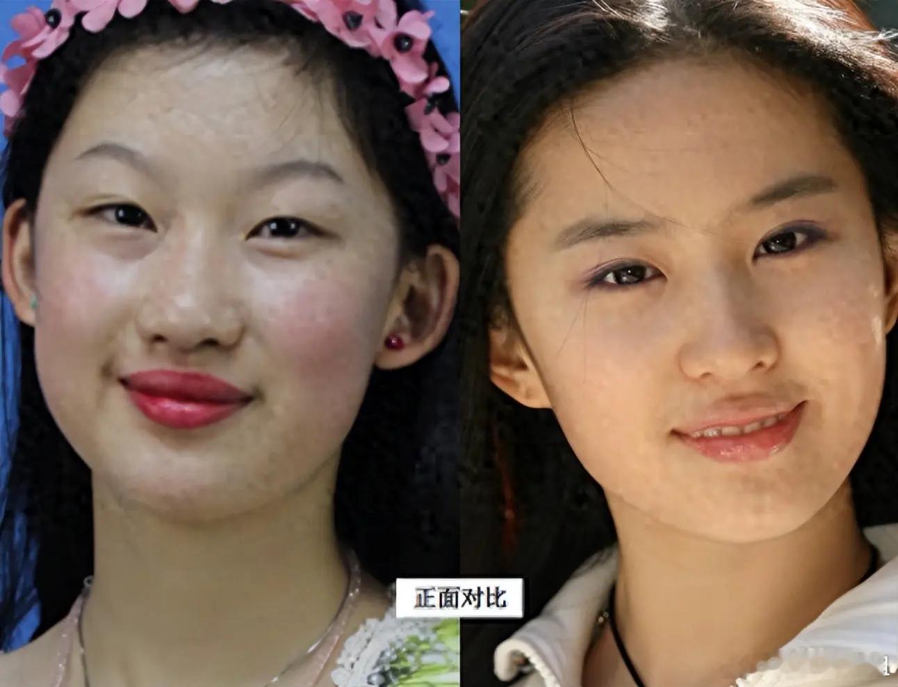 19岁少女削肉剔骨整成刘亦菲，9年后，她终归走上不同的路！ ​​​
