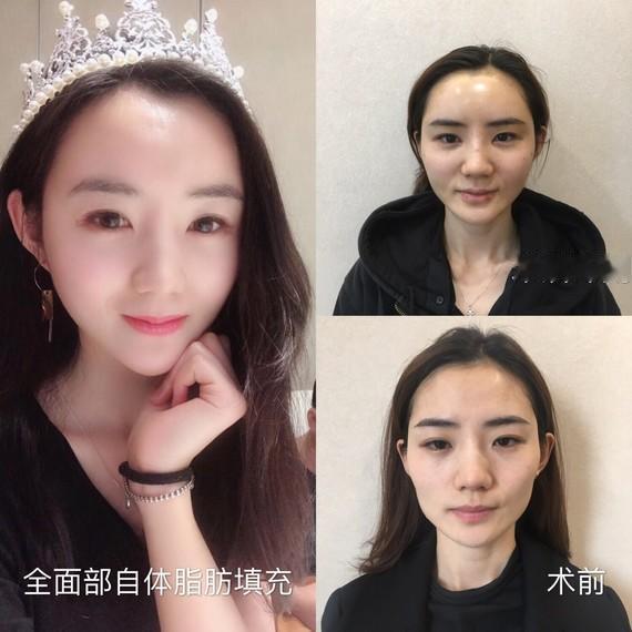 十级美颜证件照走红！真正该看重的是医生实力
 
一张证件照意外带火一位主任医师，