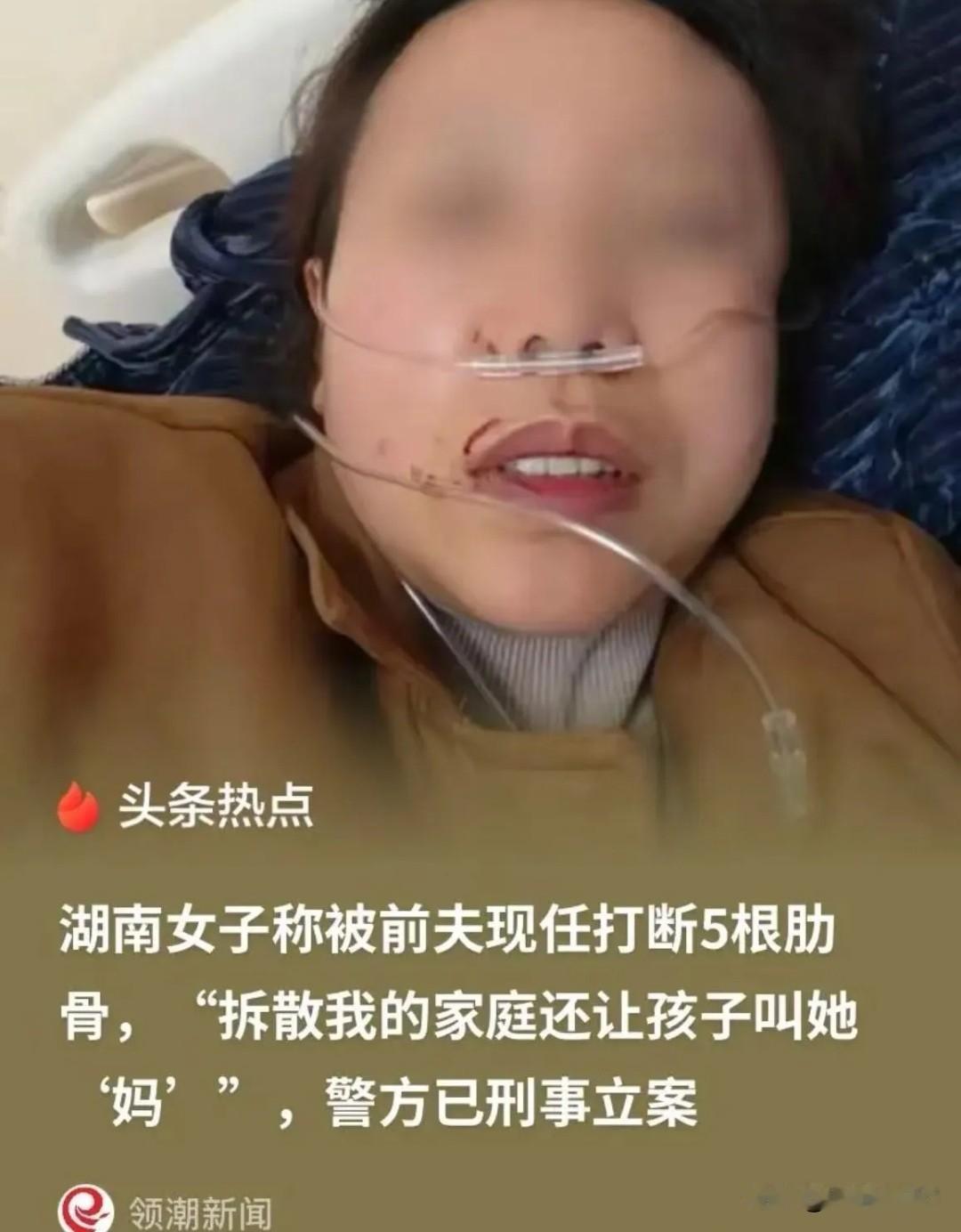 湖南娄底两名监狱干警婚内出轨重组家庭后，愣是将上门沟通的前妻殴打至五根肋骨骨折。