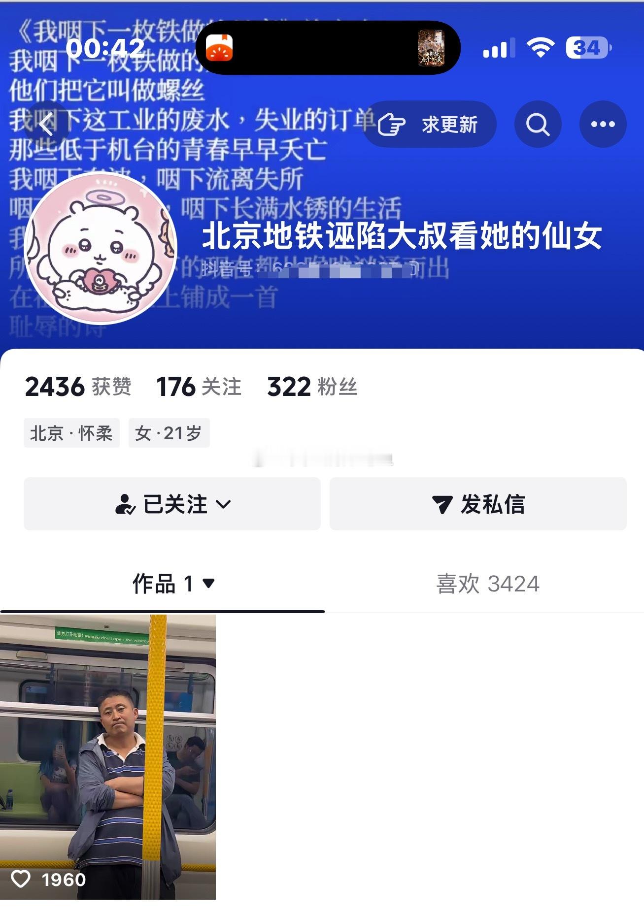 可以备注名字是我特别喜欢的功能，这样我就不会忘记，什么原因关注她了。 ​​​