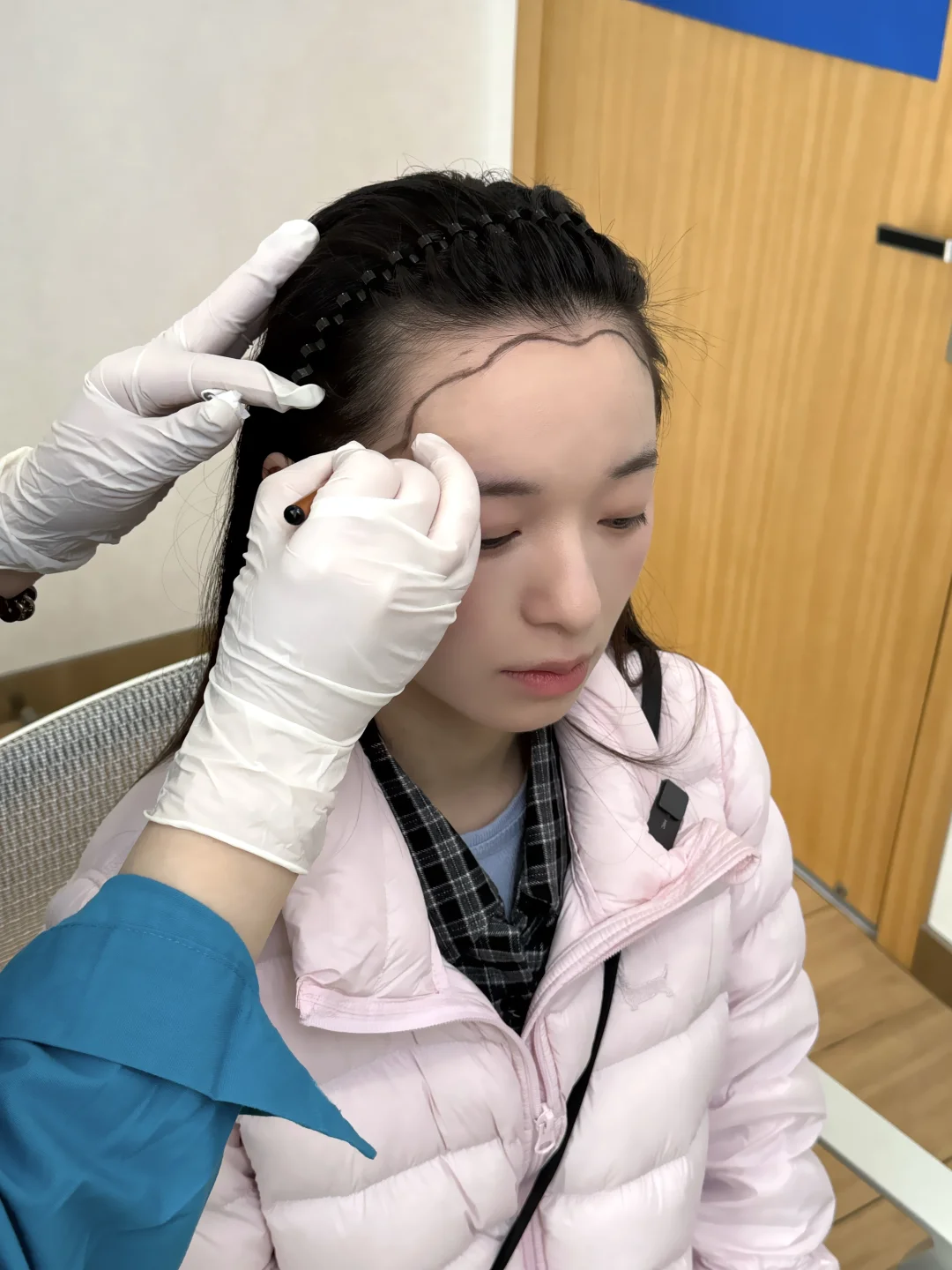 我终于去植发啦！！！