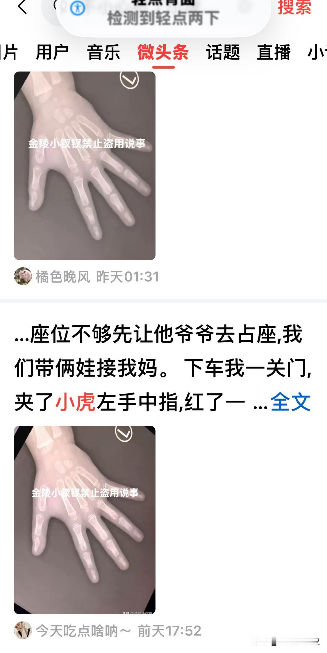 满屏都是俺家的手！

周天我不小心挤了俺家小虎的手，虽然我看着没有骨外伤，手指也
