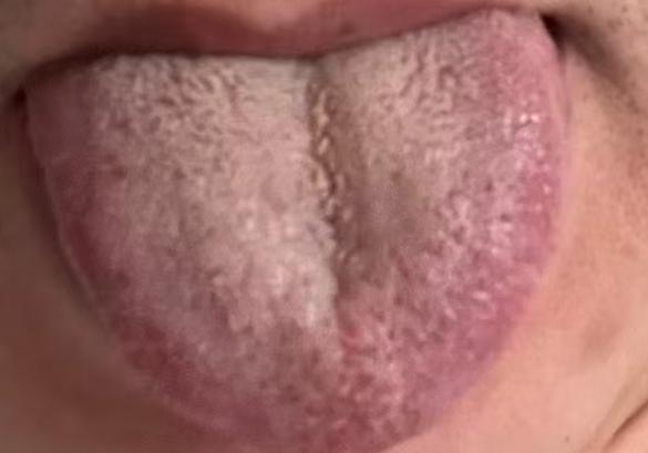 房事总力不从心状态飘忽？根源是湿瘀 + 心肾不交






有不少朋友到了中年