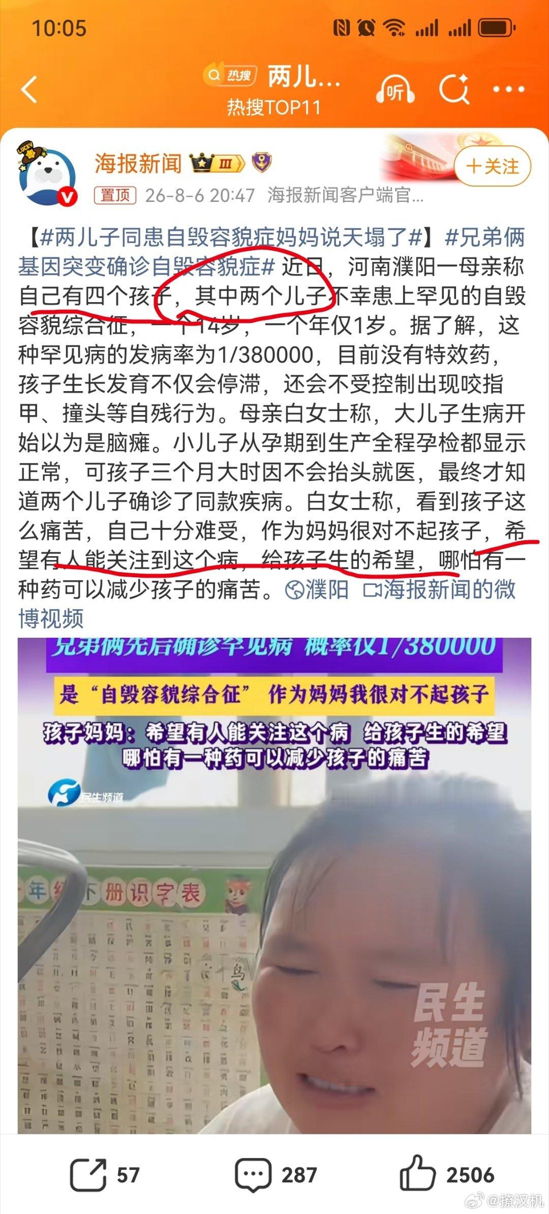 两儿子同患自毁容貌症妈妈说天塌了四个孩子？两个儿子不正常，不就代表有两个女儿是正