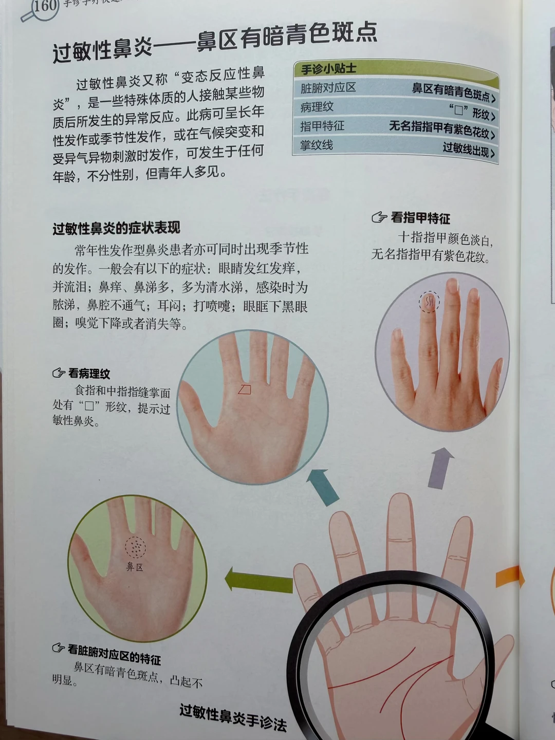 鼻炎