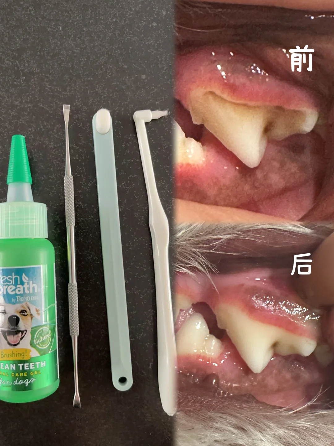 强烈推荐 一分钟在家清理牙结石