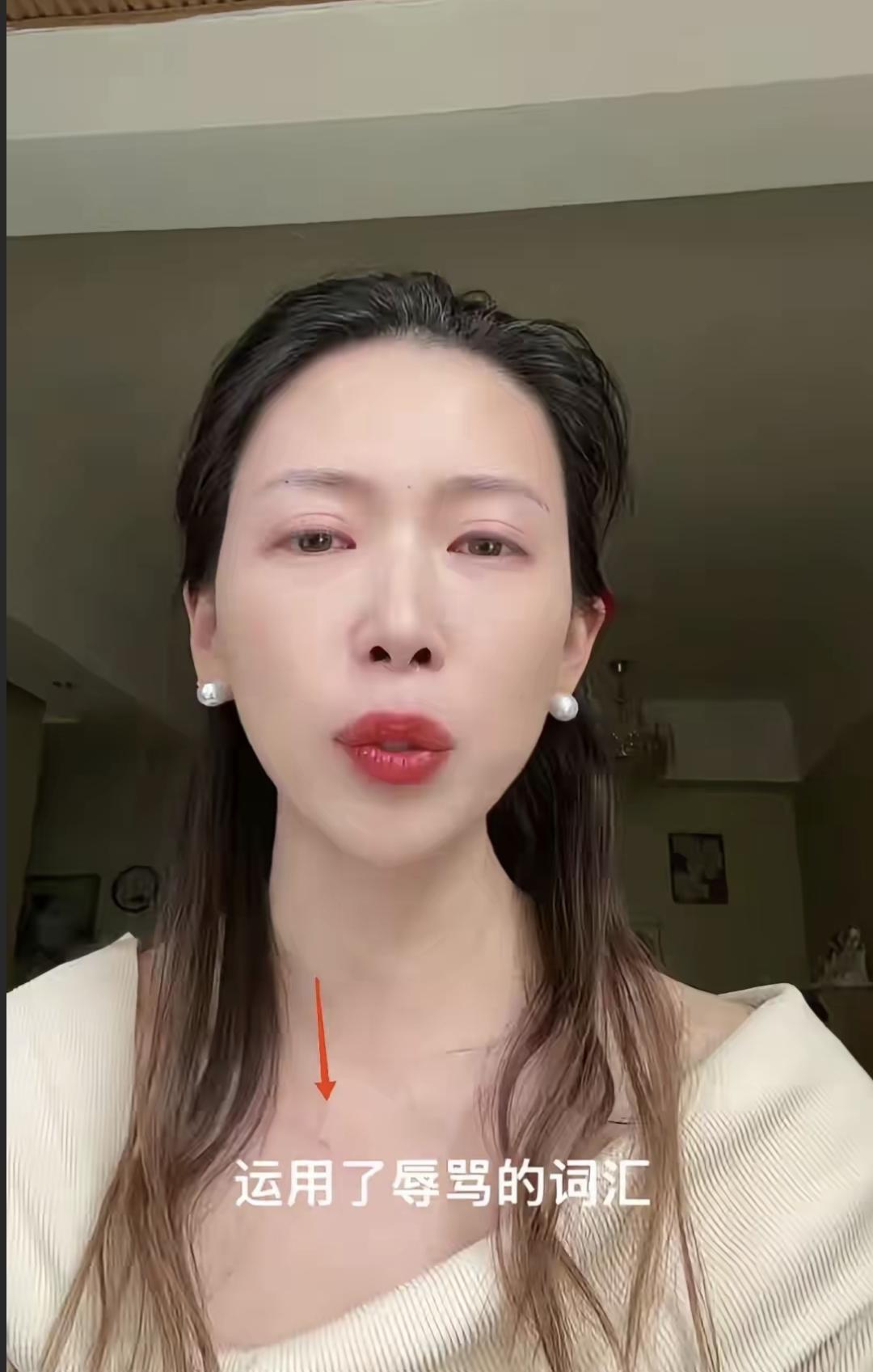 牛娜又发道歉视频了，眼眶通红，说话断断续续。法院判她连续15天公开道歉，因为她在