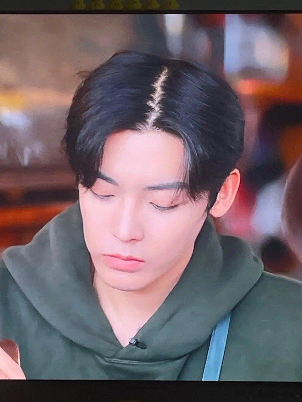 侯明昊这个发量告急啊，大家都有脱发烦恼吗[允悲] ​​​