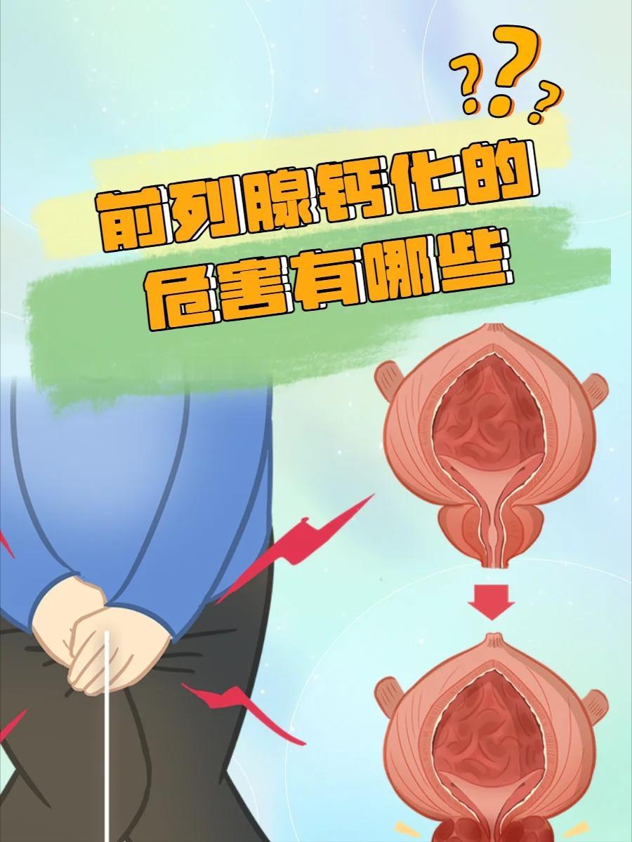 前列腺钙化的危害有哪些？带你深入了解！